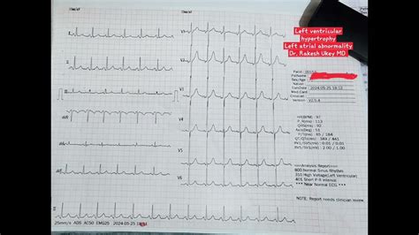 left ventricular hypertrophy lab tests